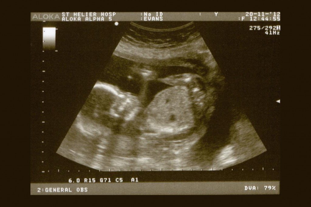 Tuesday 20th November 2012 (20 weeks)