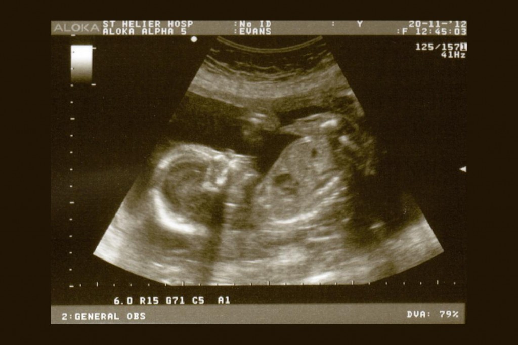 Tuesday 20th November 2012 (20 weeks)