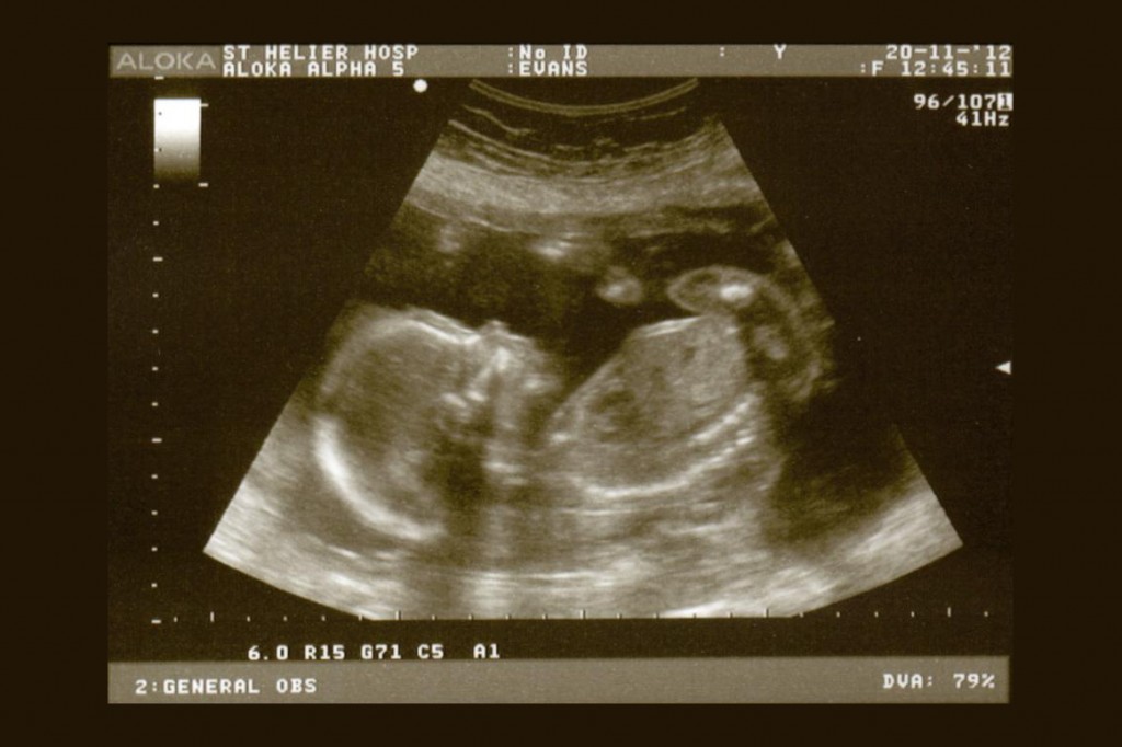 Tuesday 20th November 2012 (20 weeks)