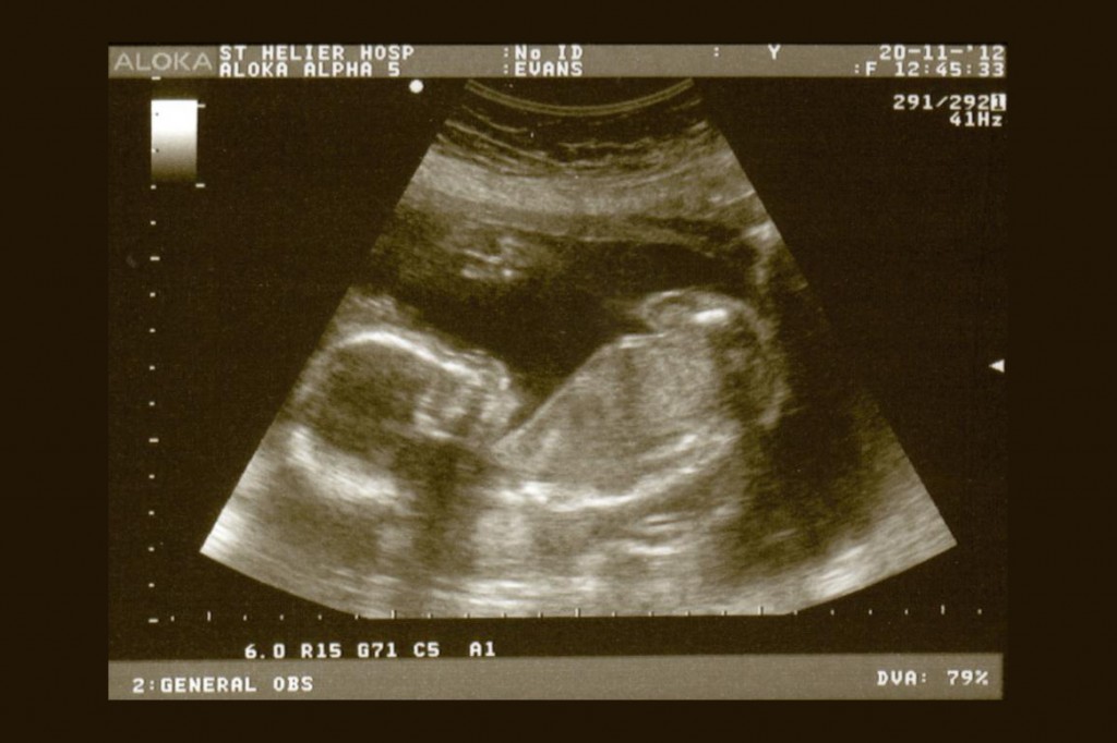 Tuesday 20th November 2012 (20 weeks)