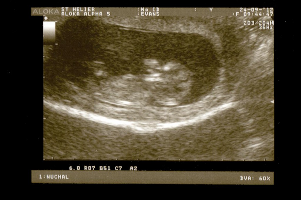 Monday 24th September 2012 (12 weeks)