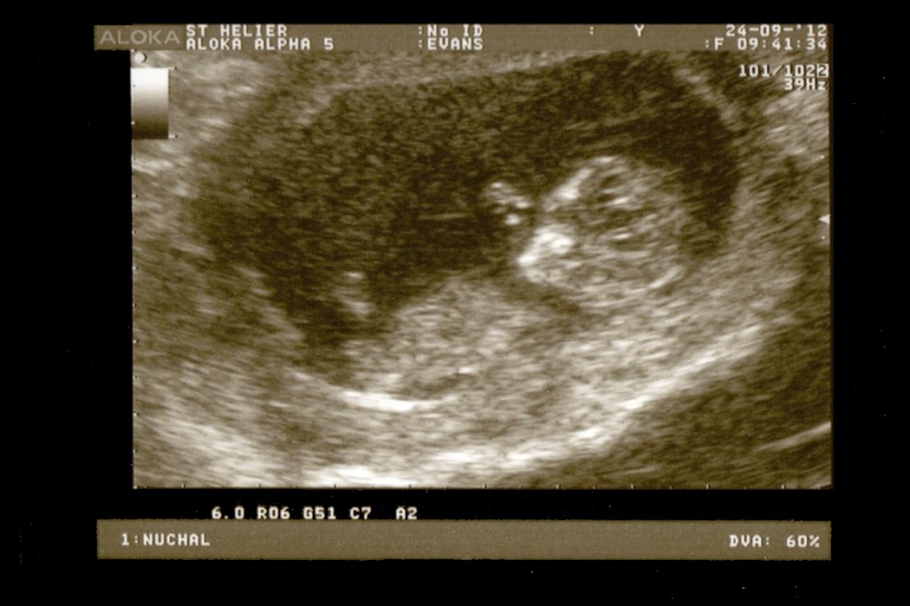 Monday 24th September 2012 (12 weeks)