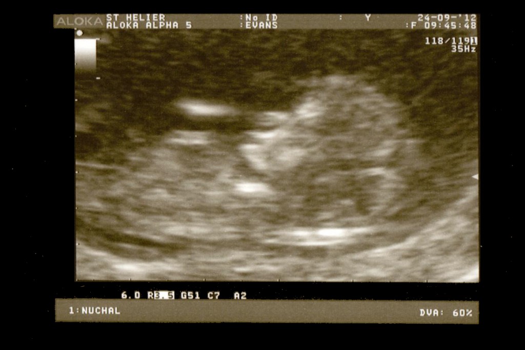 Monday 24th September 2012 (12 weeks)