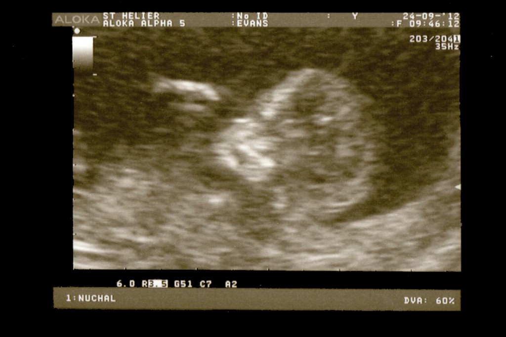 Monday 24th September 2012 (12 weeks)